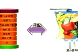 全合一營養液在腸外營養中的優勢與應用案例